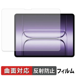 OnePlus Pad 3 �ی�t�B���� �y �ȖʑΉ� ���˒ጸ �z �L�Y�C�� ���{��