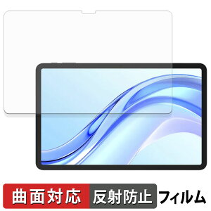 DOOGEE Tab E3+ �ی�t�B���� �y �ȖʑΉ� ���˒ጸ �z �L�Y�C�� ���{��