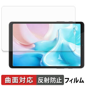 BekoQurd M8 �ی�t�B���� �y �ȖʑΉ� ���˒ጸ �z �L�Y�C�� ���{��