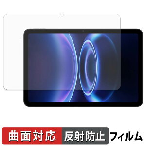 Xiaomi Redmi Pad 2 SE �ی�t�B���� �y �ȖʑΉ� ���˒ጸ �z �L�Y�C�� ���{��