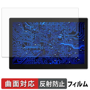 UPERFECT OD101BF �ی�t�B���� �y �ȖʑΉ� ���˒ጸ �z �L�Y�C�� ���{��