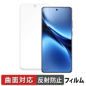 vivo X200 Pro �ی�t�B���� �y �ȖʑΉ� ���˒ጸ �z �L�Y�C�� ���{��