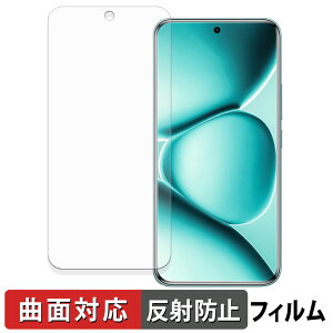 Xiaomi REDMI Note 15 Pro+ �ی�t�B���� �y �ȖʑΉ� ���˒ጸ �z �L�Y�C�� ���{��