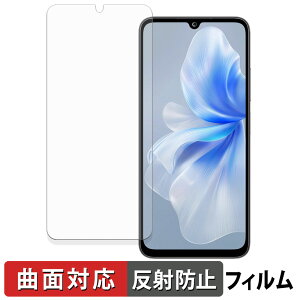 FOSSiBOT S2 �ی�t�B���� �y �ȖʑΉ� ���˒ጸ �z �L�Y�C�� ���{��