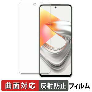 ZTE nubia S2R / S2e �ی�t�B���� �y �ȖʑΉ� ���˒ጸ �z �L�Y�C�� ���{��