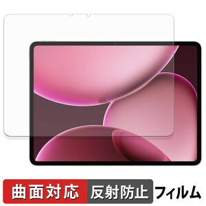 OPPO Pad 4 Pro �ی�t�B���� �y �ȖʑΉ� ���˒ጸ �z �L�Y�C�� ���{��