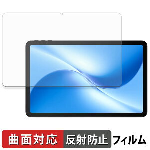 DOOGEE U12 یtB y ȖʑΉ ˒ጸ z LYC {