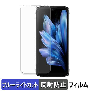 �y�|�C���g2�{�z DOOGEE Blade10 / Blade10 Ultra / Blade10 Pro �ی�t�B���� �u���[���C�g�J�b�g �t�B���� �y �ȖʑΉ� ���˒ጸ �z �L�Y�C�� ���{��