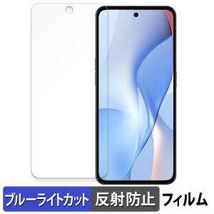 �y7/11 1:59�� �|�C���g�ő�4�{�z Yulong Coolpad COOL X100 �ی�t�B���� �u���[���C�g�J�b�g �t�B���� �y �ȖʑΉ� ���˒ጸ �z �L�Y�C�� ���{��