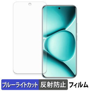 Xiaomi REDMI Note 15 Pro+ یtB u[CgJbg tB y ȖʑΉ ˒ጸ z LYC {