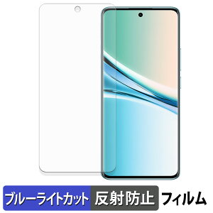 Xiaomi REDMI Note 15 �ی�t�B���� �u���[���C�g�J�b�g �t�B���� �y �ȖʑΉ� ���˒ጸ �z �L�Y�C�� ���{��