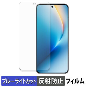 HONOR WIN / WIN RT �ی�t�B���� �u���[���C�g�J�b�g �t�B���� �y �ȖʑΉ� ���˒ጸ �z �L�Y�C�� ���{��