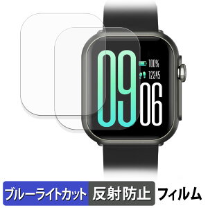 FOSMET PURE P1 (2Zbg) p یtB u[CgJbg tB y ȖʑΉ ˒ጸ z LYC {