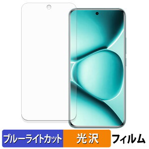 y|Cg2{z Xiaomi REDMI Note 15 Pro+ یtB u[CgJbg tB y ȖʑΉ dl z LYC {