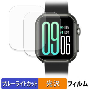 FOSMET PURE P1 (2Zbg) p یtB u[CgJbg tB y ȖʑΉ dl z LYC {