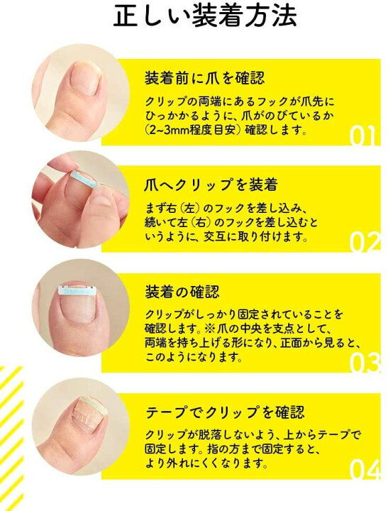 楽天市場 巻き爪 矯正クリップ ドクターショール 巻き爪用クリップ 1個入 全3サイズ ライフスタイル 生活のお手伝い