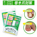 ★痛みにさようなら！★毎日快適！巻き爪リフト まきづめリフト 4本爪 1個入り フリーサイズ 巻き爪 まき爪 リフト 巻爪ケア ワイヤー 爪やすり付き 裏から持ち上げ 一般医療機器 巻き爪解消 巻き爪 治療 自分で 足の巻き爪 防止 サポーター 国産 医療用 器具 ワイヤー 巻爪