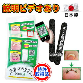 ★2個入★巻き爪 リフト ワイヤー 巻爪 ガード 巻き爪 テープ 矯 サポーター 巻きづめ 対策 クリップ 巻き爪 リフト 治 巻き爪ワイヤーガード 療 巻き爪チェーン 爪ブロック 器具 正 巻き爪 ブロック 自宅 足の巻き爪 テーピング 巻き爪用チェーン まきづめ ワイヤー ガード