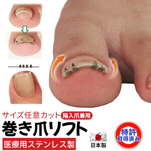 【日本製 !送料無料でこの価格!】 まきづめリフト 巻き爪リフト 巻き爪 まきづめ 巻き爪ワイヤーガード 巻爪 まきづめ 巻きつめ まきつめ 自宅 グッズ 器具 ブロック ワイヤー 痛い 手術