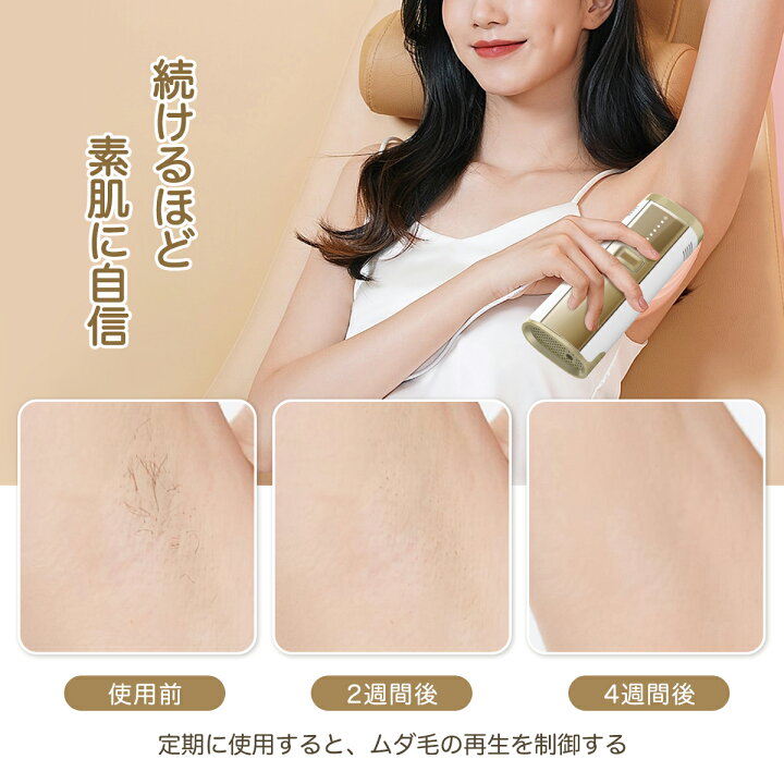 楽天市場】＼10%OFFクーポン／脱毛器 家庭用脱毛器 IPL光 だつもうき 