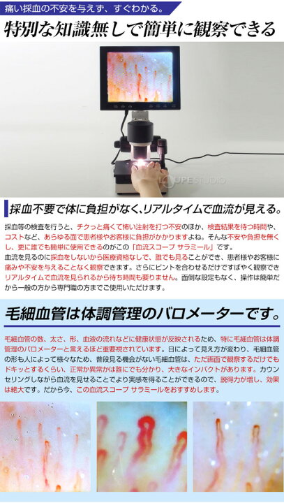 楽天市場】顕微鏡 血流スコープ サラミール 血管 検査 毛細血管 無採血 