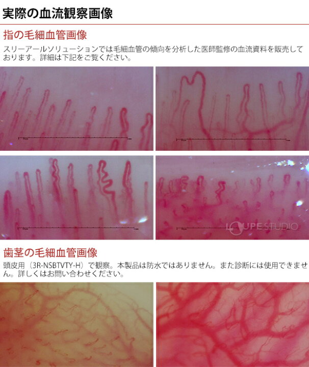 楽天市場】顕微鏡 血流スコープ 肌 血流観察 チェック 確認 検査 頭皮  