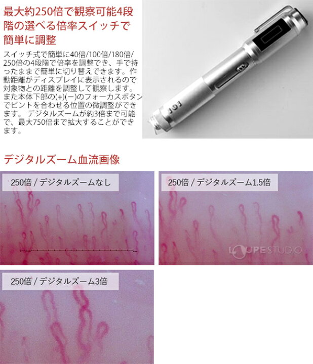 楽天市場】顕微鏡 血流スコープ 肌 血流観察 チェック 確認 検査 頭皮 