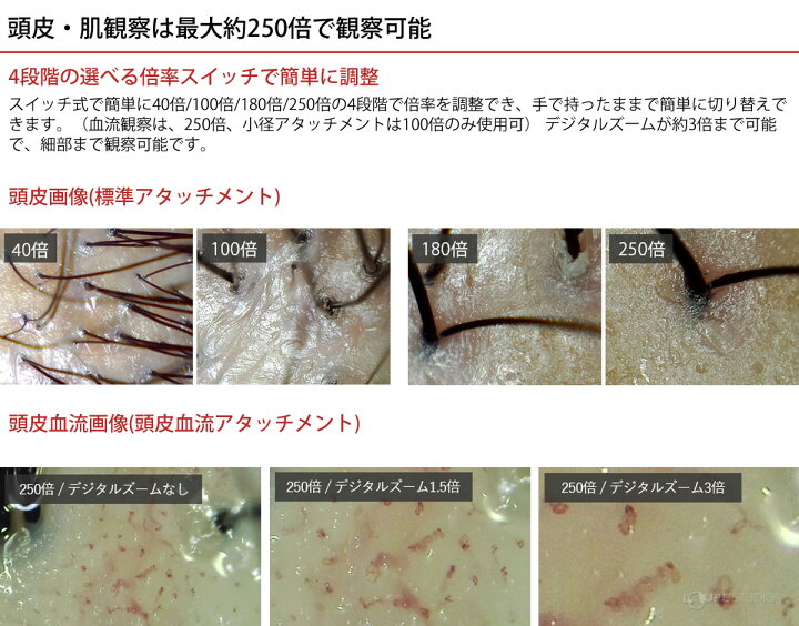 楽天市場 顕微鏡 血流スコープ 頭皮 肌 マイクロスコープ 頭皮血流アタッチメント付 オートフォーカスviewty サロン 美容 血流観察 検査 最大250倍 高倍率 チェック 確認 ルーペスタジオ 楽天市場 顕微鏡 血流スコープ 頭皮 肌 マイクロスコープ 頭皮血流アタッチメント付 オートフォーカスviewty サロン 美容 血流観察 検査 最大250倍 高倍率 チェック 確認 ルーペスタジオ