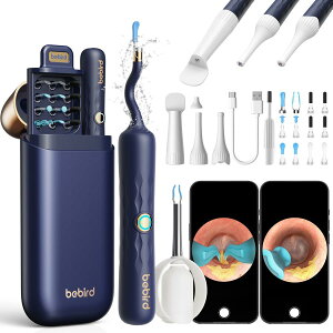 2026�ŐV ������ �J���� bebird Note3 Pro ���C�g ���� �s���Z�b�g LED 1000����f ���~�� �X�R�[�v 2in1 WIFI�ڑ� ���� ���� �q�ǂ� ��