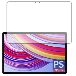 PDA�H�[ Xiaomi Redmi Pad Pro �Ή� PerfectShield �ی� �t�B���� (��ʗp) ���˒ጸ �h�w�� ���{��