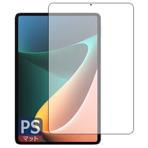 PDA�H�[ Xiaomi Pad 5 11 / Xiaomi Pad 5 Pro 11�Ή� PerfectShield �ی� �t�B���� (��ʗp) ���˒ጸ �h�w�� ���{��
