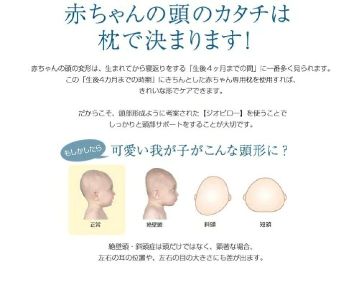 楽天市場 50 Offクーポン 12 26まで ベビー 枕 絶壁頭予防 ジオピロー ベビー用品 新生児 赤ちゃん Gio Pillow ドーナツ枕 通気性 洗える 頭の形 枕 まくら 矯正 絶壁防止 アトピー あせも 抗菌 向き癖 防ダニ 0ヶ月 6ヶ月 出産祝い プレゼント 送料無料 Nopi