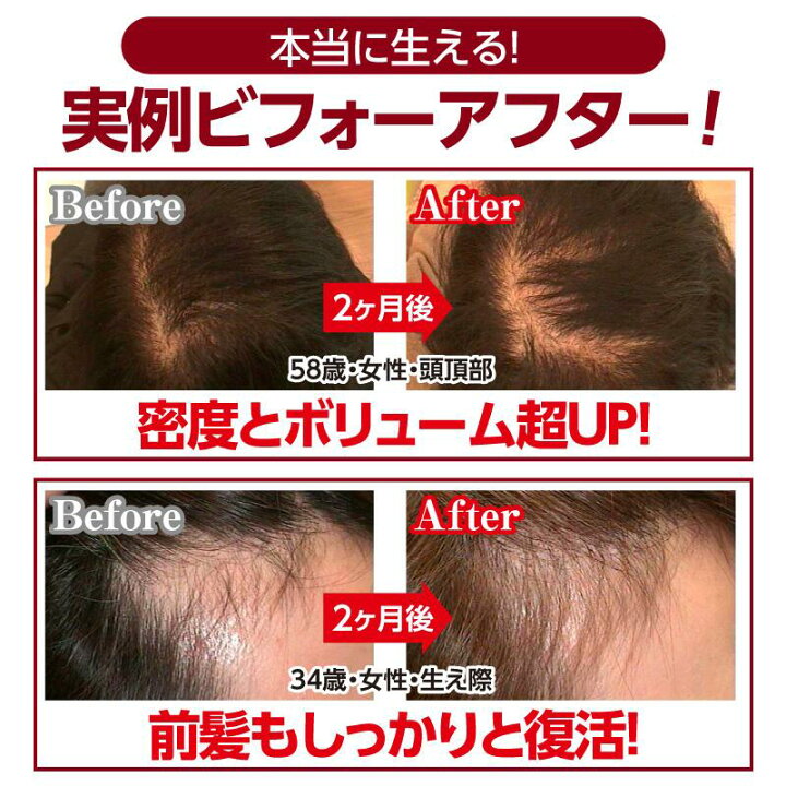 楽天市場】【正規品取扱店】【レビューで「ヘアオイル」プレゼント 