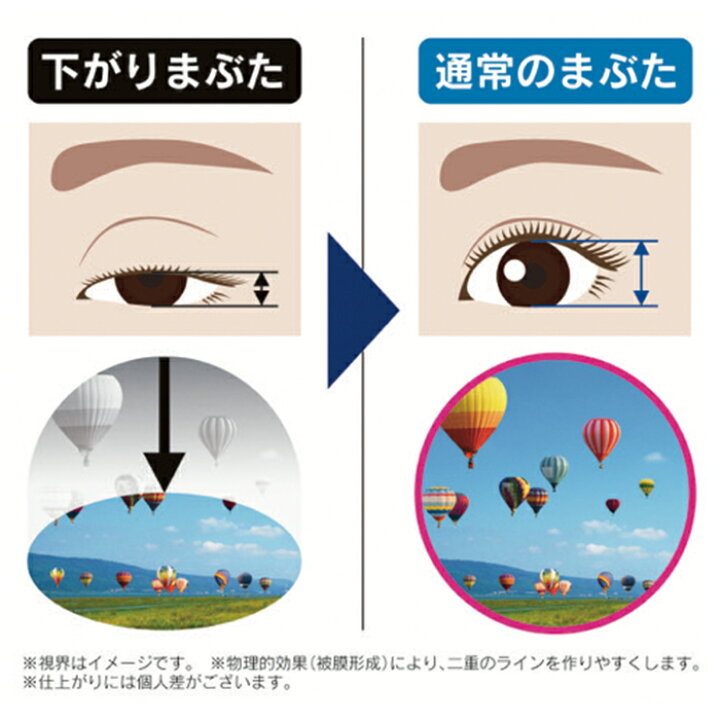 楽天市場 メーカー公式 送料無料 ゆうパケット対応 視界良好 まぶた引き上げジェル 2ml まぶた 二重 たるみ たれ 垂れ 下がる 重たい 目元 アイケア 一重 奥二重 ひとえ ふたえ 瞼 形成 デカ目 簡単 クセ付け セラミド プラセンタ ヒアルロン酸 日本製 まる