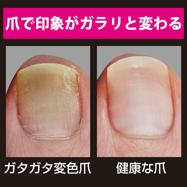 楽天市場 3 オフクーポンあり バブルクリアネイル 爪 つめ 変色 黄ばみ 乾燥 ガタガタ爪 自爪ケア用品 つるつる しっとり きれいな手 ローズの香り ネイルケア 変色 乾燥 ガタガタ 汚爪 自爪 重曹泡 もこもこ 簡単 美爪 まるモール 楽天市場店