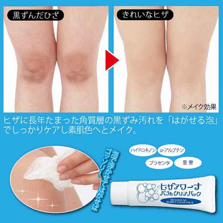 楽天市場 クーポンで5 オフ ヒザアワーナ バブルクリアパック ひざ ひじ 膝 肘 泡パック 黒ずみ汚れ くすみ ハイドロキノン A アルブチン プラセンタ 重曹 まるモール 楽天市場店