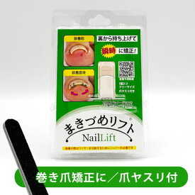 まきづめリフト正規品 巻き爪 巻きづめ 矯正 ワイヤー 親指 ケア つめ ネイル 補整 巻爪 一般医療機器[ネコポス対応商品]