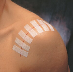 �y���������z�X�e���X�g���b�v �X�^���_�[�h �X�L���N���[�V��- R1547 3M12mm×100mm�@6�{/��×50�ܓ�