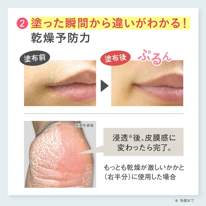 楽天市場】【公式】メディプラス オールインワンジェル 180g (約2か月 