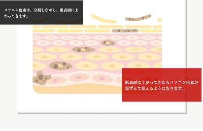 デリケートゾーンの黒ずみ対策ローションBe89【医薬部外品】美白エッセンスローション30ml乳首マタニティー乳頭バスト黒づみくろずみ毛穴ケアボディローションレディースお尻陰部乳輪VIO膝ひざ鼻肘ひじ国産