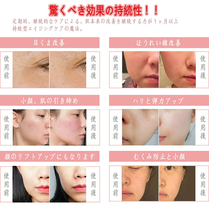 楽天市場】【衝撃の50％OFF！】美顔器 リフトアップ 高周波RFラジオ波 
