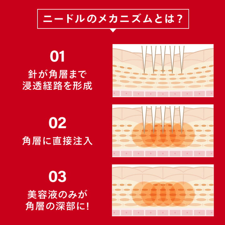 楽天市場】【公式販売】CONC リンクル インジェクション 2.5mL 