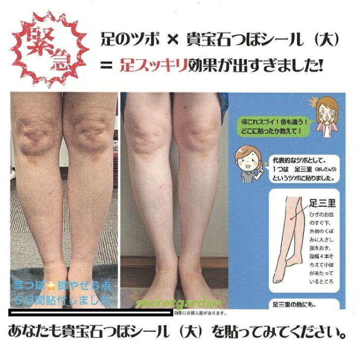 楽天市場 足やせの極意プレゼント 貴宝石パワーシール 大 28個入り 足のツボ 貴宝石つぼシール 体のツボ用 足スッキリ モニター実感率100 送料無料 クリックポスト発送 脚やせ 足痩せ 美脚 脚痩せ むくみ解消 足つぼ みみデコshop 楽天市場 足やせの極意プレゼント 貴宝石パワーシール 大 28個入り 足のツボ 貴宝石つぼシール 体のツボ用 足スッキリ モニター実感率100 送料無料 クリックポスト発送 脚やせ 足痩せ 美脚 脚痩せ むくみ解消 足つぼ みみデコshop
