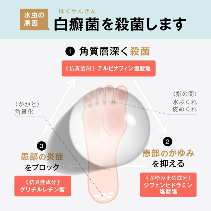 楽天市場 水虫薬 ハイミズムシールexクリーム 10g 指定第2類医薬品 いんきんたむし 市販薬 かゆみ 臭い テルビナフィン塩酸塩クリーム ミナカラ薬局