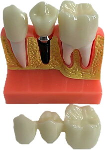 ͌^ ȗp Cvg͌^ ̖͌^ Uw ȃCvg͌^ ȃfXg[V O\