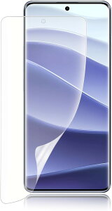 1������Redmi Note 14 Pro 5G �t�B�����ی�t�B���� �w��F�ؑΉ� ���˖h�~ �A���`�O���A �S�ʋz�� TPU�t�B���� (89K-CSJ-AR389)