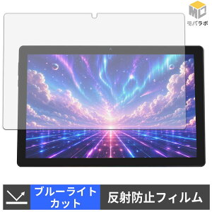 FancyDay X10APRO �u���[���C�g�J�b�g �ی�t�B���� �A���`�O���A �w��h�~ ���˖h�~ �t���ی�t�B����
