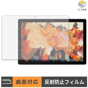 HiGrace MB1001 TPU �ی�t�B���� �A���`�O���A �L�Y�C�� �w��h�~ ���˖h�~ �t���ی�t�B����