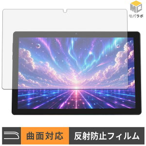 FancyDay X10APRO TPU �ی�t�B���� �A���`�O���A �L�Y�C�� �w��h�~ ���˖h�~ �t���ی�t�B����