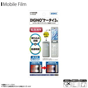 DIGNOP[^C4 A202KC A203KC A204KC / DIGNOP[^C3 902KC 903KC 904KC ttB AR-903KCy4931z ARtB2 f荞ݗ} x ѓdh~ tB ʕیASDEC AXfbN